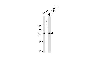 Western blot analysis in A431 cell line and mouse bladder tissue lysates (35ug/lane). (14-3-3 sigma/SFN antibody  (AA 120-149))