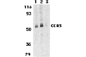 Western Blotting (WB) image for anti-Chemokine (C-C Motif) Receptor 3 (CCR3) (C-Term) antibody (ABIN1030329) (CCR3 antibody  (C-Term))