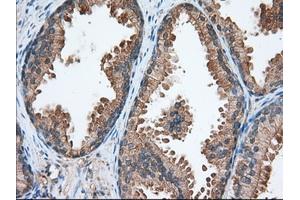 Immunohistochemical staining of paraffin-embedded Human liver tissue using anti-TACC3 mouse monoclonal antibody. (TACC3 antibody)