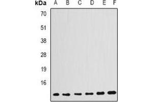Western blot analysis of GABARAP expression in HepG2 (A), Jurkat (B), PC12 (C), mouse kidney (D), mouse brain (E), rat kidney (F) whole cell lysates. (GABARAP antibody)