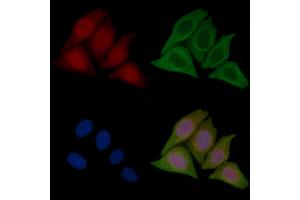ABIN7096448 and ABIN7100512 staining Hela cells(45 min of heat-shock treatment) by IF/ICC.