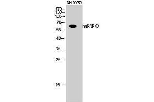 Western Blotting (WB) image for anti-Synaptotagmin Binding, Cytoplasmic RNA Interacting Protein (SYNCRIP) (Internal Region) antibody (ABIN3185069)
