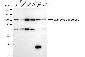 Western blotting analysis using diacylglycerol kinase zeta antibody (ABIN7798328).