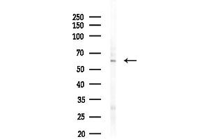 anti-Zinc Finger Protein 497 (ZNF497) antibody