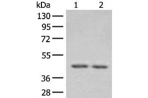 Western blot analysis of 293T cell lysates using ILKAP Polyclonal Antibody at dilution of 1:800 (ILKAP antibody)
