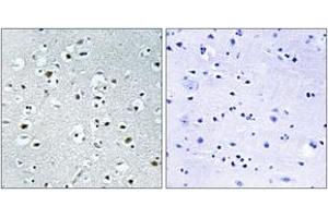 Immunohistochemistry analysis of paraffin-embedded human brain tissue, using PPRC1 Antibody.