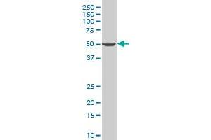 PRPF19 polyclonal antibody (A01), Lot # 051121JC01 Western Blot analysis of PRPF19 expression in HeLa . (PRP19 antibody  (AA 1-90))