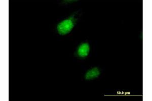 Immunofluorescence of purified MaxPab antibody to MAD2L1BP on HeLa cell.