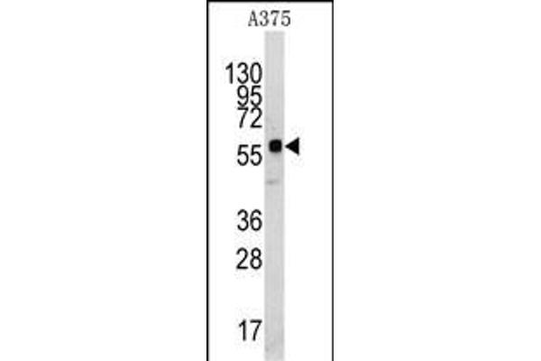 KREMEN1 antibody  (N-Term)