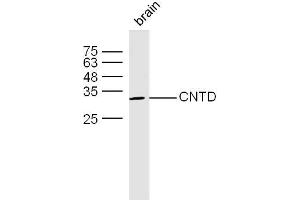 Mouse bone lysates probed with CNTD Polyclonal Antibody, unconjugated  at 1:300 overnight at 4°C followed by a conjugated secondary antibody at 1:10000 for 60 minutes at 37°C. (CNTD1 antibody)