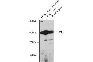 Western blot analysis of extracts of various cell lines, using K antibody (ABIN7268147) at 1:1000 dilution. (KANK2 antibody  (AA 1-300))