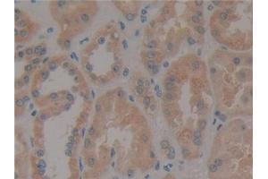 Immunohistochemistry (IHC) image for anti-Paxillin (PXN) (AA 201-461) antibody (ABIN7434188)