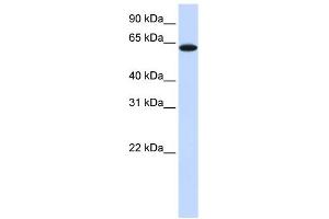 TYRP1 antibody used at 1 ug/ml to detect target protein. (Tyrosinase-Related Protein 1 antibody  (Middle Region))
