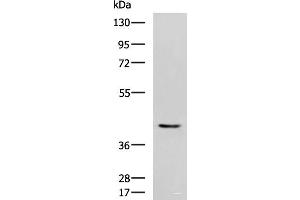 Western blot analysis of Mouse heart tissue lysate using STK32A Polyclonal Antibody at dilution of 1:1000 (STK32A antibody)