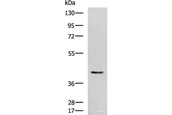 STK32A 抗体