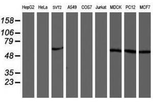 Image no. 1 for anti-V-Akt Murine Thymoma Viral Oncogene Homolog 1 (AKT1) antibody (ABIN1496559) (AKT1 antibody)