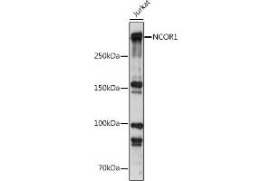 Western blot analysis of extracts of Jurkat cells, using NCOR1 antibody (ABIN6130574, ABIN6144420, ABIN6144421 and ABIN6222831) at 1:500 dilution.