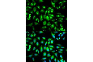 Immunofluorescence analysis of MCF-7 cells using CHRM2 antibody (ABIN5970748). (Muscarinic Acetylcholine Receptor M2 antibody)