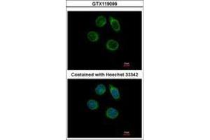 Image no. 2 for anti-Carbohydrate (N-Acetylglucosamine-6-O) Sulfotransferase 2 (CHST2) (AA 246-469) antibody (ABIN1497516) (CHST2 antibody  (AA 246-469))