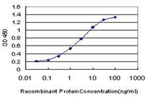 Detection limit for recombinant GST tagged FGFR1 is approximately 0. (FGFR1 antibody  (AA 31-150))