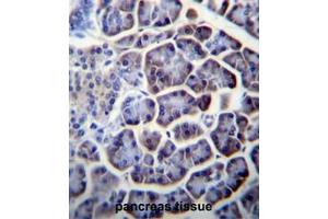 PC Antibody (N-term) immunohistochemistry analysis in formalin fixed and paraffin embedded human pancreas tissue followed by peroxidase conjugation of the secondary antibody and DAB staining. (PC antibody  (N-Term))