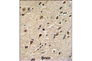 Formalin-fixed and paraffin-embedded human brain with DDX5 Antibody (Center), which was peroxidase-conjugated to the secondary antibody, followed by DAB staining. (DDX5 antibody  (AA 306-334))