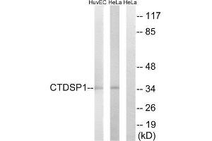 Western Blotting (WB) image for anti-CTD (Carboxy-terminal Domain, RNA Polymerase II, Polypeptide A) Small Phosphatase 1 (CTDSP1) (N-Term) antibody (ABIN1851030) (CTDSP1 antibody  (N-Term))
