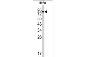 Western blot analysis of CPXM2 antibody (N-term) (ABIN390476 and ABIN2840841) in HL60 cell line lysates (35 μg/lane). (CPXM2 antibody  (N-Term))