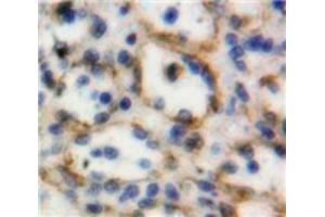 Used in DAB staining on fromalin fixed paraffin-embedded Spleen tissue (TNFSF8 antibody  (AA 60-227))