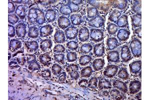 Paraformaldehyde-fixed, paraffin embedded mouse small intestine, Antigen retrieval by boiling in sodium citrate buffer(pH6) for 15min, Block endogenous peroxidase by 3% hydrogen peroxide for 30 minutes, Blocking buffer (normal goat serum) at 37°C for 20min, Antibody incubation with Rabbit Anti-PAG1 Polyclonal Antibody, Unconjugated  at 1:400 overnight at 4°C, followed by a conjugated secondary and DAB staining (PAG1 antibody  (AA 331-432))