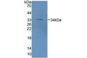 Detection of Recombinant PCDH15, Mouse using Polyclonal Antibody to Protocadherin 15 (PCDH15) (PCDH15 antibody  (AA 45-270))