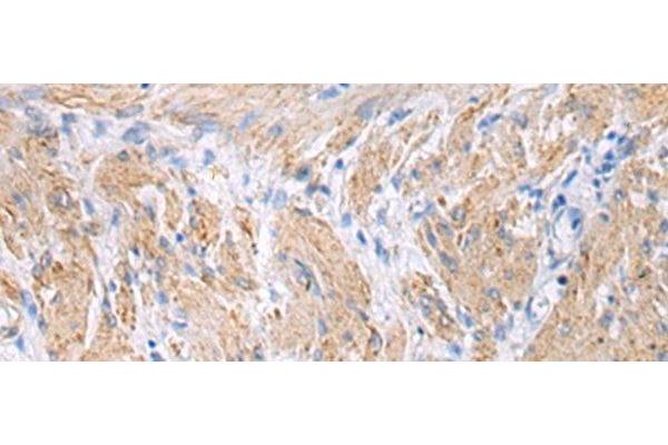 FBXO45 antibody