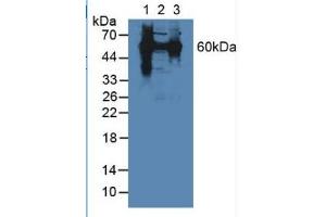 Western Blotting (WB) image for Heat Shock 60kDa Protein 1 (Chaperonin) (HSPD1) ELISA Kit (ABIN6574223)