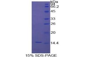 SDS-PAGE analysis of Cow Inhibin beta A Protein.