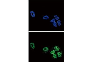 Confocal immunofluorescent analysis of PLA2G4A Antibody (Center) (ABIN652449 and ABIN2842304) with NCI- cell followed by Alexa Fluor? (PLA2G4A antibody  (AA 513-541))