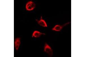 ABIN6268893 staining HepG2 by IF/ICC. (Integrin beta 4 antibody  (C-Term))