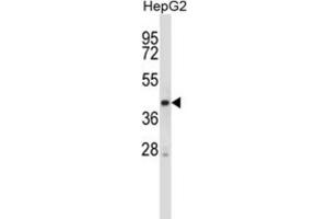 Western Blotting (WB) image for anti-serine/threonine Kinase 25 (STK25) antibody (ABIN2998007) (STK25 antibody)