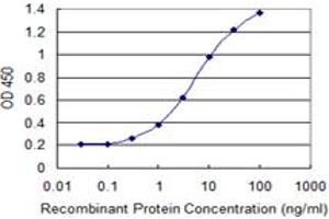 Detection limit for recombinant GST tagged WTAP is 0. (WTAP antibody  (AA 70-151))