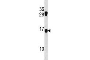 MDS1 antibody western blot analysis in mouse NIH3T3 lysate. (MECOM antibody  (AA 81-109))