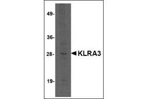 Western blot analysis of KLRA3 in mouse brain tissue lysate with this product at 2 μg/ml.