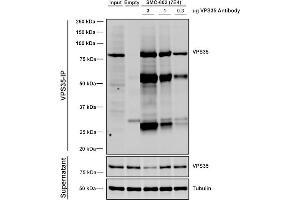 Immunoprecipitation analysis using Mouse Anti-VPS35 Monoclonal Antibody, Clone 7E4 (ABIN6932927).