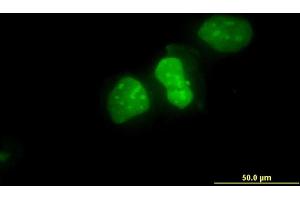 Immunofluorescence of monoclonal antibody to XRCC6 on HeLa cell.