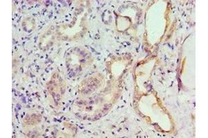 Immunohistochemistry of paraffin-embedded human kidney tissue using ABIN7153301 at dilution of 1:100 (GRK6 antibody  (AA 1-170))