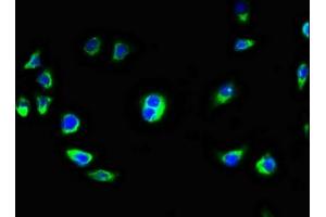 Immunofluorescence staining of A549 cells with ABIN7145860 at 1:100, counter-stained with DAPI. (KCTD7 antibody  (AA 5-152))