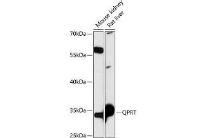 Western blot analysis of extracts of various cell lines, using QPRT antibody (ABIN7269781) at 1:3000 dilution. (QPRT antibody  (AA 1-297))