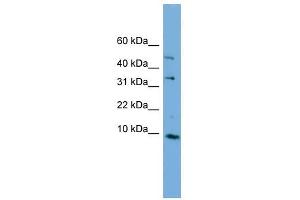 C16ORF61 antibody used at 1 ug/ml to detect target protein. (C16orf61 antibody  (Middle Region))