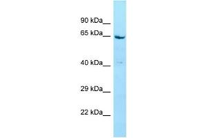WB Suggested Anti-STXBP4 Antibody Titration: 1. (STXBP4 antibody  (N-Term))