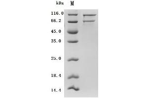 (Tris-Glycine gel) Discontinuous SDS-PAGE (reduced) with 5 % enrichment gel and 15 % separation gel.