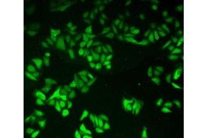 Detection of GR in Human Hela Cells using Polyclonal Antibody to Glutathione Reductase (GR) (Glutathione Reductase antibody  (AA 240-500))