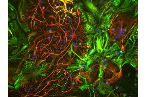 View of mixed neuron/glial cultures stained with Vimentin antibody (green) our our rabbit antibody to GFAP antibody (RPCA-GFAP, red). (Vimentin antibody)